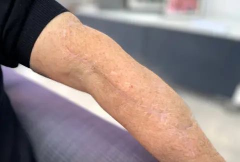 Surviving the Unthinkable: A Man's Wild Encounter with a Bull Shark in Tobago