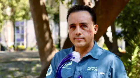 Biologist Survives Shark Attack, Hopes to Reunite with the Beast