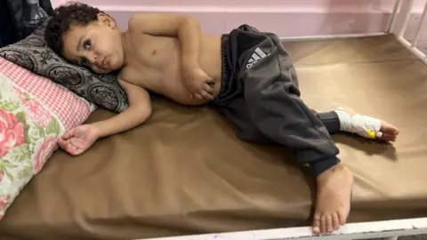 Children in Gaza Face Dire Medical Crises Amidst Delayed Evacuations